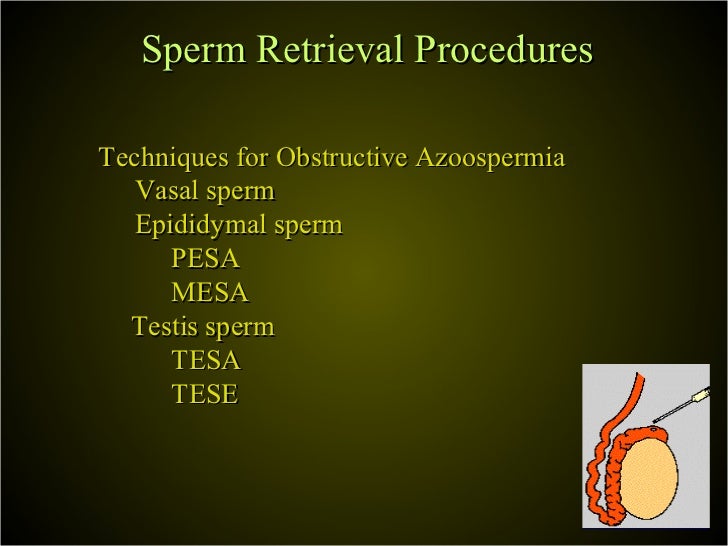Fibrosis in sperm Fibrosis in sperm